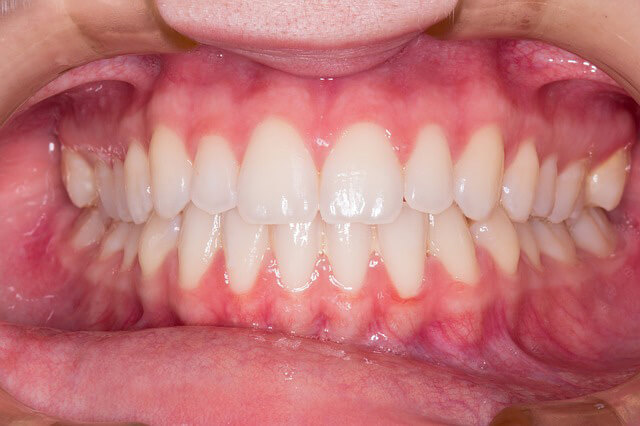 Safety Bay Dental Care Centre Gum Disease Diagnosis and Treatments Services